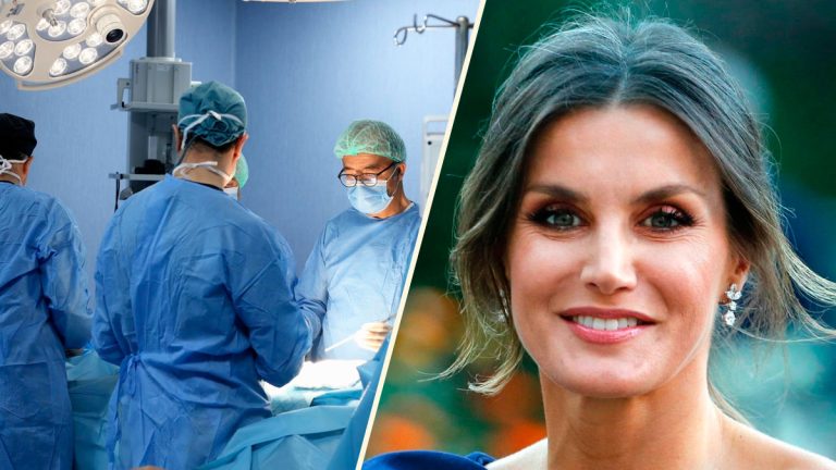 These are the cosmetic surgeries that royals have undergone Cirurgies of the royals