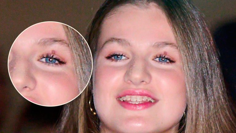 What happened to Princess Leonor in the eye? The heiress also shows changes in her teeth (PHOTOS) Princess Leonor's eye injury