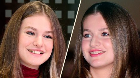 The story behind Princess Leonor’s teeth and dental treatment What was the problem with Princess Leonor's teeth