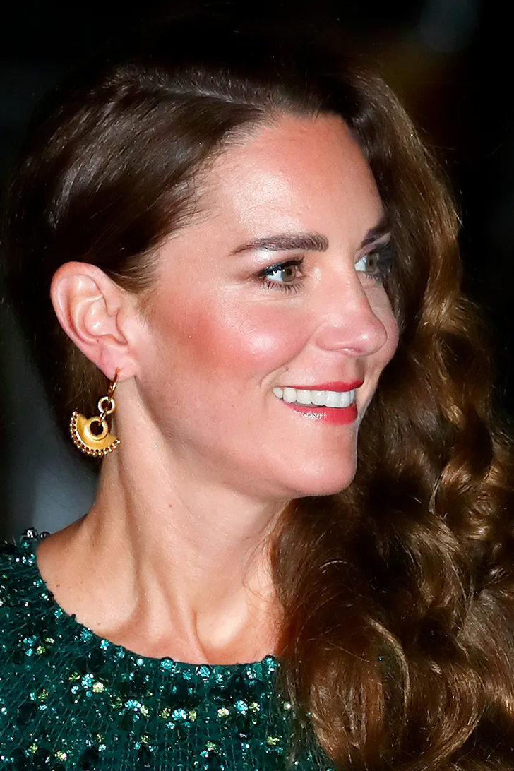 Kate Middleton botox