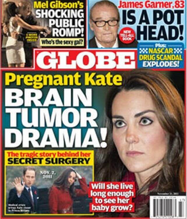 Kate Middleton Brain Tumor Drama by Globe Magazine