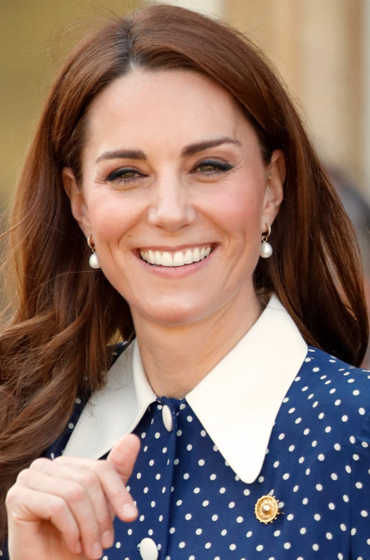 Kate Middleton teeth now