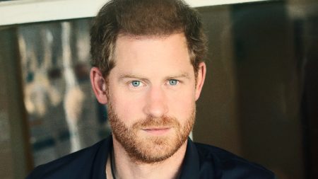 PHOTOS: Did Prince Harry have a hair transplant? prince harry's hair transplant