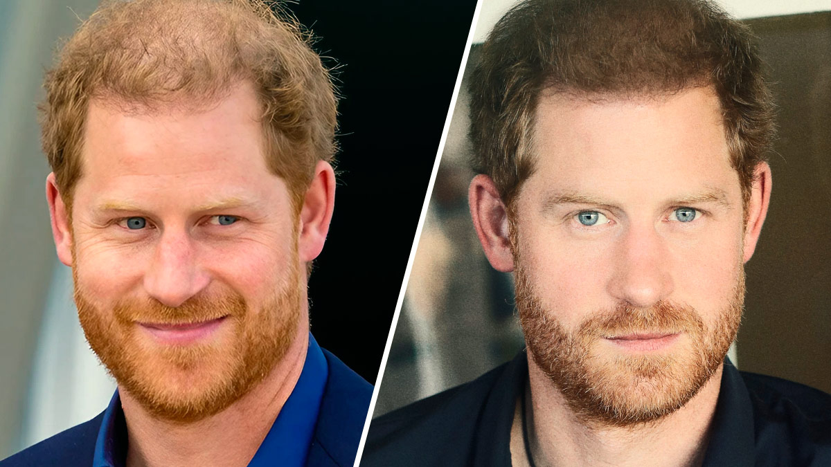 prince harry hair Better Up