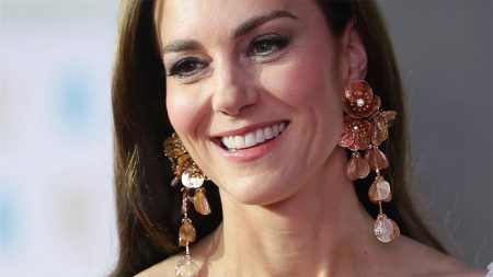 Kate Middleton plastic surgery