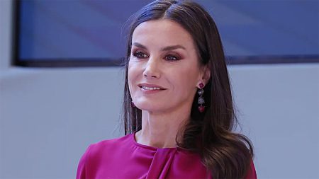 Queen Letizia's cosmetic surgeries