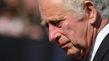 King Charles hospitalized