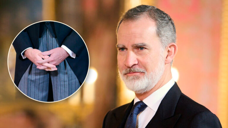 Why does King Felipe VI have a purple left hand? Felipe's hand purple