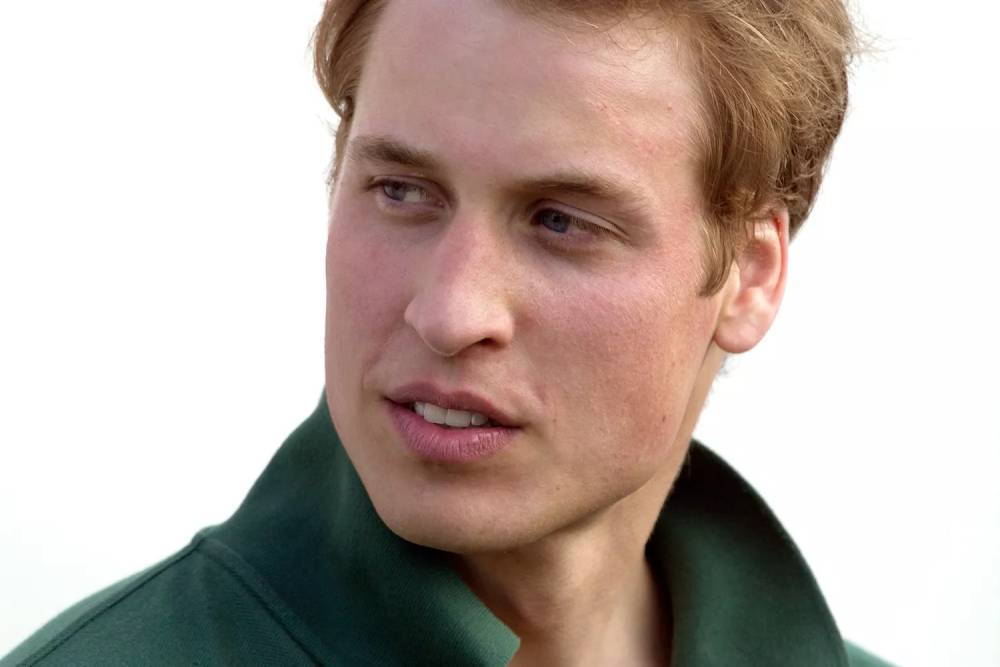 The curious revelation that Prince William has made about the scar on his face Prince William's scar