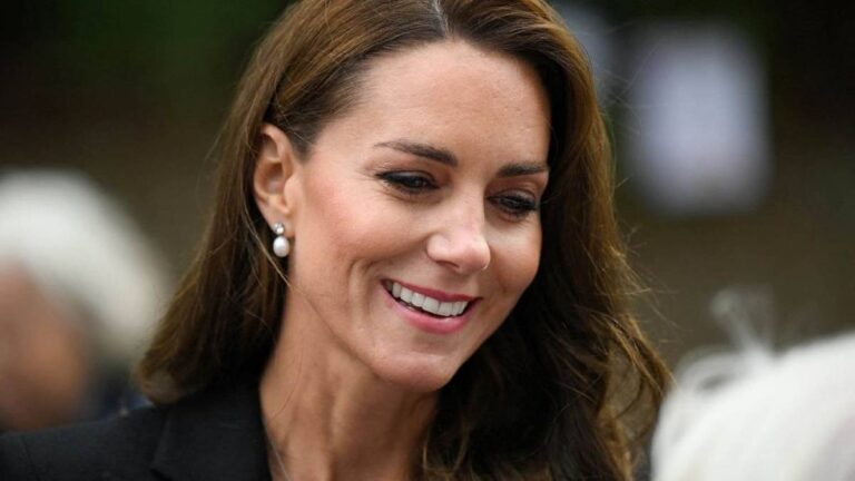 The press reveals the trend of cosmetic surgery inspired by the Princess of Wales Kate Middleton Cosmetic Surgeries Inspired by Kate Middleton