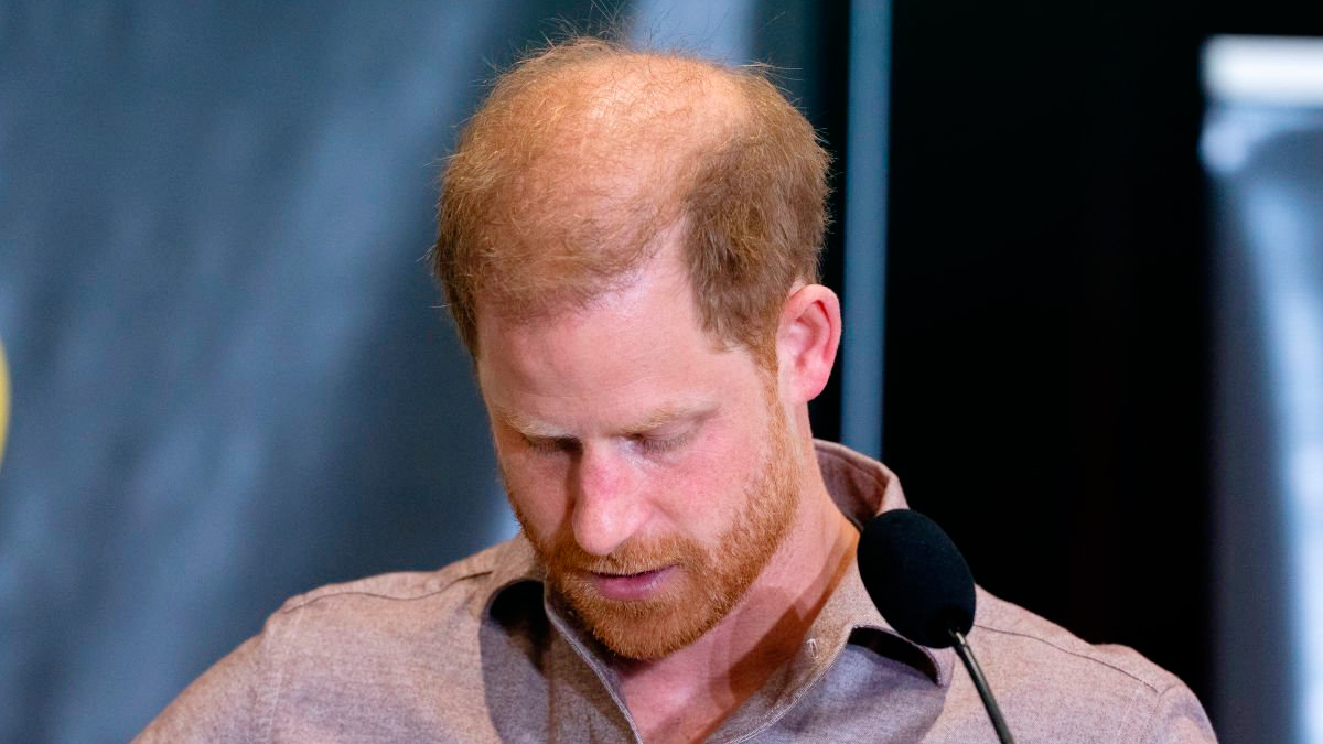 Prince Harry Balding
