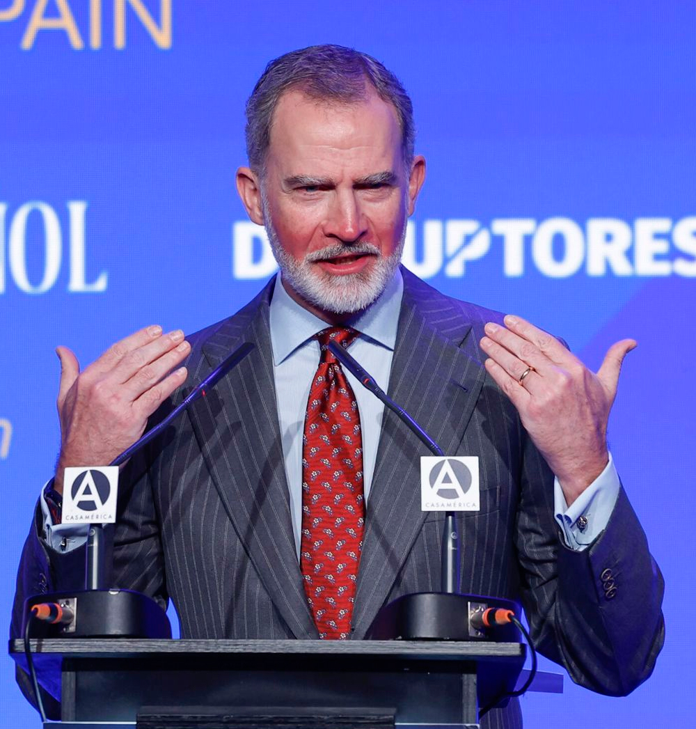 King Felipe's Sunburn