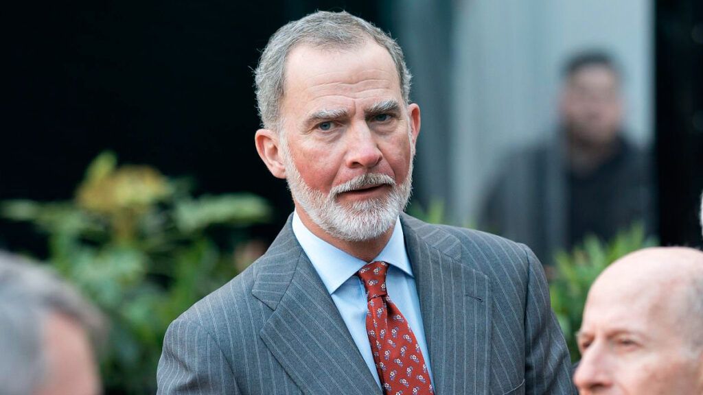 King Felipe's Sunburn