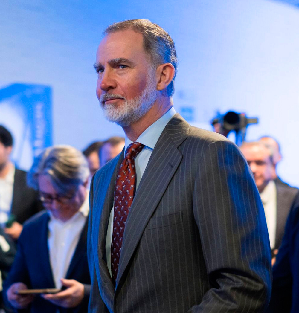 King Felipe's Sunburn