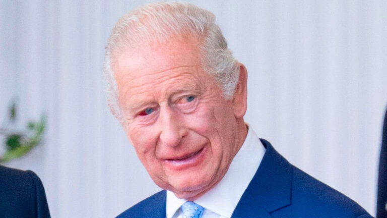 What Happened to King Charles’ Eye? The Palace Responds After Worrying Images What happened to King Charles' eye