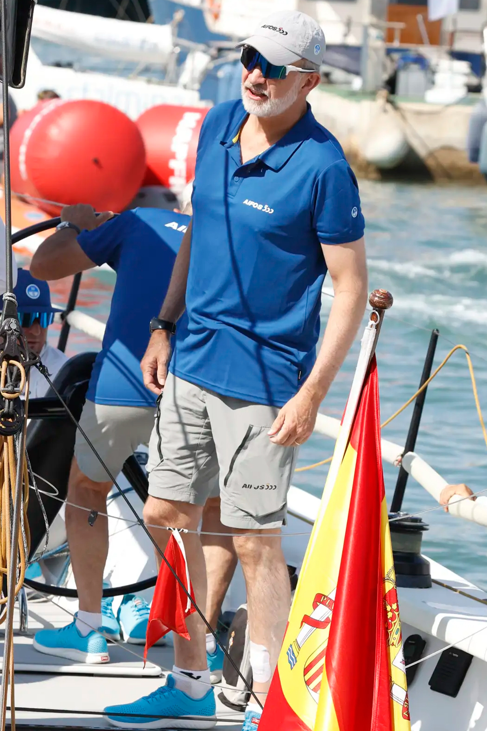 King Felipe is wearing a bandage on his leg.